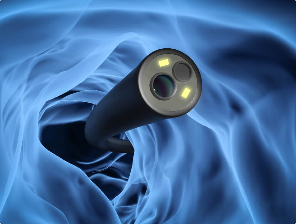 鼴鼠醫(yī)療和您探討:一次性支氣管鏡的優(yōu)勢 鼴鼠醫(yī)療和您探討:一次性支氣管鏡的優(yōu)勢