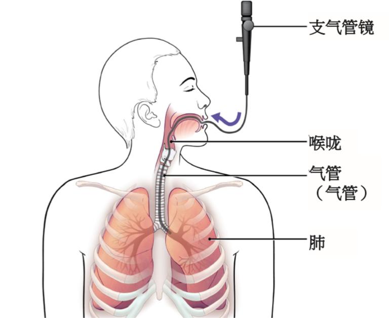 電子支氣管鏡卓越品質(zhì):為呼吸健康保駕護(hù)航 電子支氣管鏡卓越品質(zhì):為呼吸健康保駕護(hù)航
