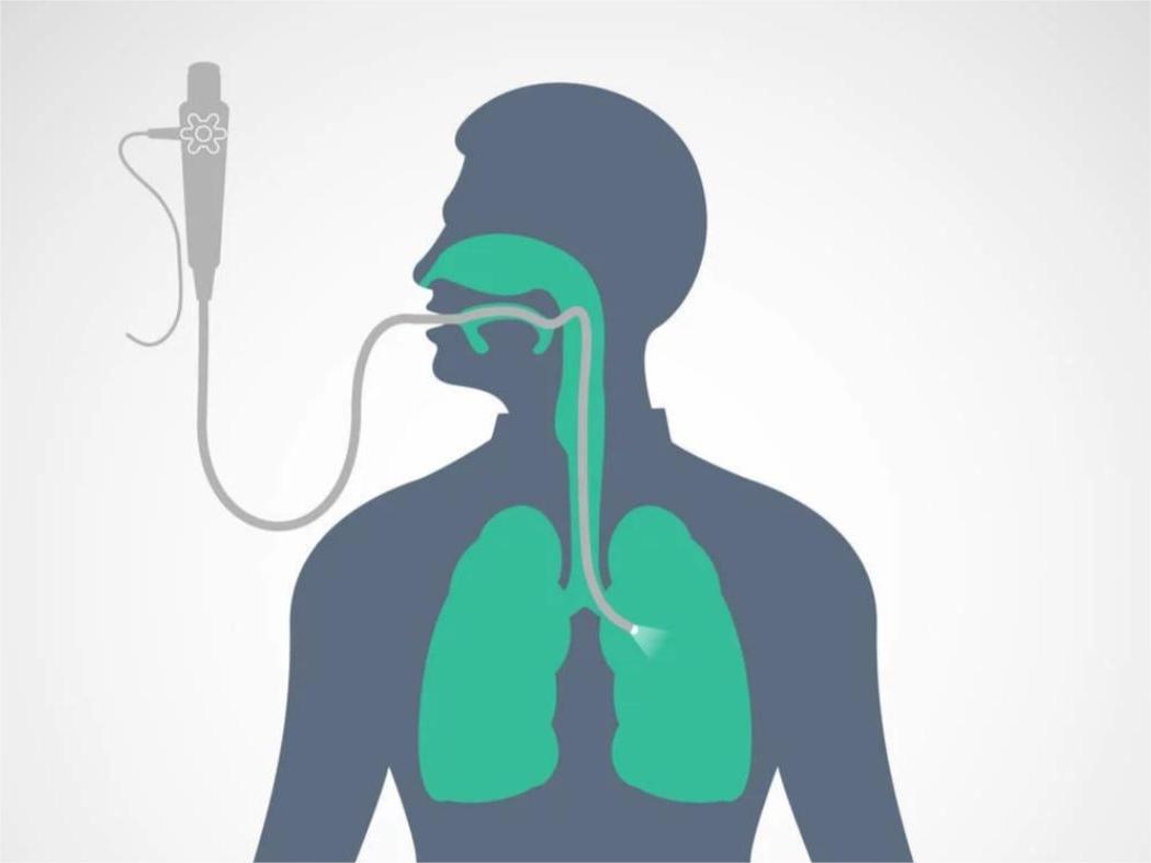 電子支氣管鏡廠家給您介紹：吸痰操作技巧